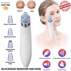 Blackhead Remover Vacuum
