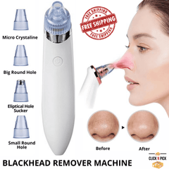 Blackhead Remover Vacuum